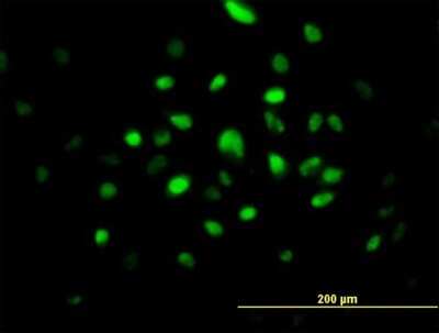 Immunocytochemistry/Immunofluorescence: SMNDC1 Antibody [H00010285-B01P] - Analysis of purified antibody to SMNDC1 on HeLa cell. (antibody concentration 10 ug/ml)