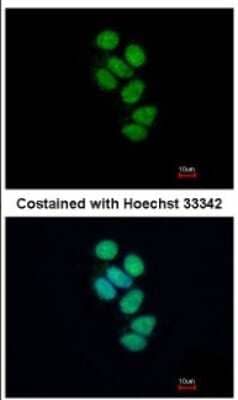 Immunocytochemistry/Immunofluorescence: SMNDC1 Antibody [NBP2-20424] - Analysis of paraformaldehyde-fixed MCF-7, using antibody at 1:500 dilution.