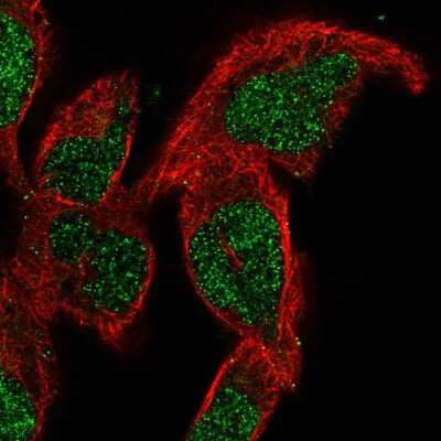 Immunocytochemistry/Immunofluorescence: SMNDC1 Antibody [NBP2-56111] - Staining of human cell line RH-30 shows localization to nucleoplasm.