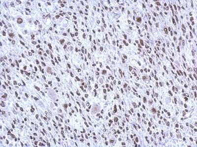 Immunohistochemistry-Paraffin: SMNDC1 Antibody [NBP2-20424] - C2C12 xenograft, using SMNDC1 antibody at 1:500 dilution. Antigen Retrieval: Trilogy™ (EDTA based, pH 8.0) buffer, 15min. 