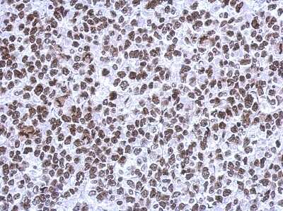 Immunohistochemistry-Paraffin: SMNDC1 Antibody [NBP2-20424] - SNU1 xenograft, using SMNDC1 antibody at 1:500 dilution. Antigen Retrieval: Trilogy™ (EDTA based, pH 8.0) buffer, 15min. 