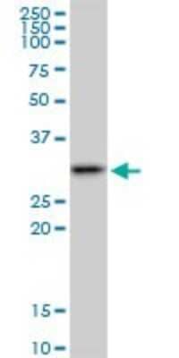 Western Blot: SMNDC1 Antibody [H00010285-B01P] - Analysis of SMNDC1 expression in A-431.