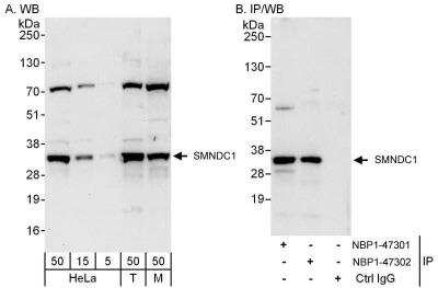 Western Blot: SMNDC1 Antibody [NBP1-47301] - Samples:  Whole cell lysate from HeLa (5, 15 and 50 ug for WB; 1 mg for IP, 20% of IP loaded), 293T (T; 50 ug), and mouse NIH3T3 (M; 50 ug) cells.  Antibodies: Affinity purified rabbit anti-SMNDC1 antibody NBP1-47301 used for WB at 0.04 ug/ml (A) and 1 ug/ml (B) and used for IP at 3 ug/mg lysate.  SMNDC1 was also immunoprecipitated by rabbit anti-SMNDC1 antibody NBP1-47302, which recognizes a downstream epitope.   Detection: Chemiluminescence with exposure times of 30 seconds (A) and 3 seconds (B).