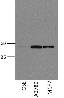 Western Blot: SMNDC1 Antibody [NBP1-47302] - Whole cell lysates from ovarian surface epithial cells (OSE), ovarian cancer cell line A2780, breast cancer cell line MCF7. Image submitted by a verified customer review. 