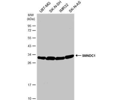 Western Blot: SMNDC1 Antibody [NBP2-20424] - Various whole cell extracts (30 ug) were separated by 12% SDS-PAGE, and the membrane was blotted with SMNDC1 antibody [N1C3-2] diluted at 1:1000. The HRP-conjugated anti-rabbit IgG antibody (NBP2-19301) was used to detect the primary antibody.