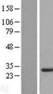 Western Blot: SMNDC1 Overexpression Lysate (Adult Normal) [NBL1-16245] Left-Empty vector transfected control cell lysate (HEK293 cell lysate); Right -Over-expression Lysate for SMNDC1.