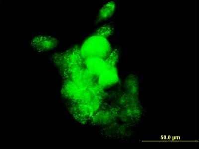 Immunocytochemistry/Immunofluorescence: SMOC-1 Antibody (8F10) [H00064093-M03] - Analysis of monoclonal antibody to SMOC1 on A-431 cell. Antibody concentration 10 ug/ml