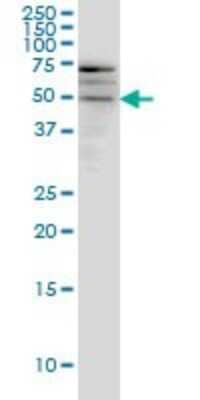 Western Blot: SMOC-1 Antibody (8F10) [H00064093-M03] - Analysis of SMOC1 expression in A-431 (Cat # L015V1).