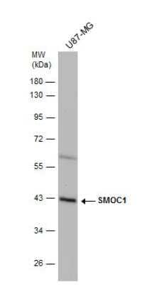 Western Blot: SMOC-1 Antibody [NBP2-15123] - Whole cell extract (30 ug) was separated by 10% SDS-PAGE, and the membrane was blotted with SMOC1 antibody [N2C3]  diluted at 1:500.