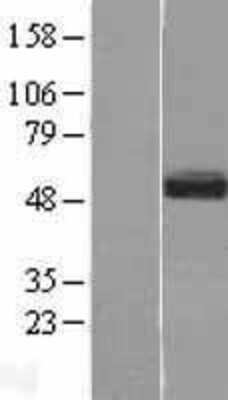 Western Blot: SMOC1 Overexpression Lysate (Adult Normal) [NBL1-16246] - Western Blot experiments.  Left-Control; Right -Over-expression Lysate for SMOC1