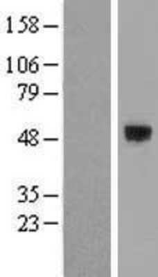 Western Blot: SMOC1 Overexpression Lysate (Adult Normal) [NBL1-16247] Left-Empty vector transfected control cell lysate (HEK293 cell lysate); Right -Over-expression Lysate for SMOC1.