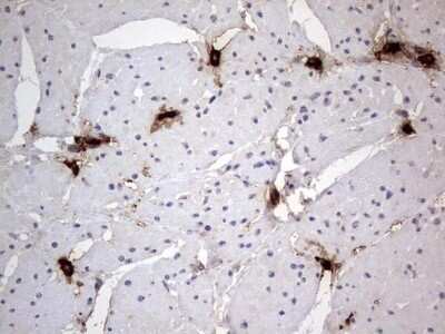 Immunohistochemistry: SMPD1 Antibody (OTI3H7) - Azide and BSA Free [NBP2-74240] - Analysis of Human bladder tissue. (Heat-induced epitope retrieval by 1 mM EDTA in 10mM Tris, pH8.5, 120C for 3min)