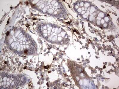 Immunohistochemistry: SMPD1 Antibody (OTI3H7) - Azide and BSA Free [NBP2-74240] - Analysis of Human colon tissue. (Heat-induced epitope retrieval by 1 mM EDTA in 10mM Tris, pH8.5, 120C for 3min)