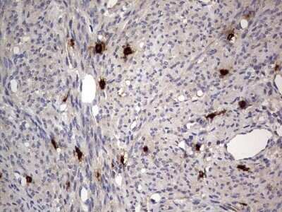 Immunohistochemistry: SMPD1 Antibody (OTI3H7) - Azide and BSA Free [NBP2-74240] - Analysis of Human endometrium tissue. (Heat-induced epitope retrieval by 1 mM EDTA in 10mM Tris, pH8.5, 120C for 3min)