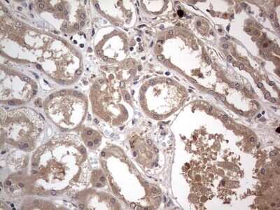 Immunohistochemistry: SMPD1 Antibody (OTI3H7) - Azide and BSA Free [NBP2-74240] - Analysis of Human Kidney tissue. (Heat-induced epitope retrieval by 1 mM EDTA in 10mM Tris, pH8.5, 120C for 3min)