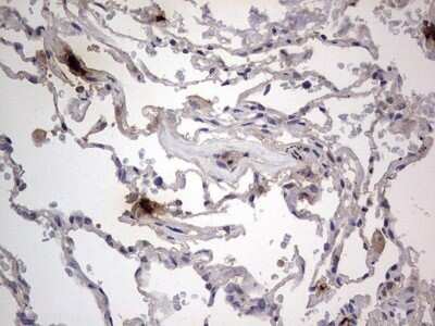 Immunohistochemistry: SMPD1 Antibody (OTI3H7) - Azide and BSA Free [NBP2-74240] - Analysis of Human lung tissue. (Heat-induced epitope retrieval by 1 mM EDTA in 10mM Tris, pH8.5, 120C for 3min)