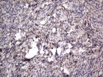 Immunohistochemistry: SMPD1 Antibody (OTI3H7) - Azide and BSA Free [NBP2-74240] - Analysis of Human Ovary tissue. (Heat-induced epitope retrieval by 1 mM EDTA in 10mM Tris, pH8.5, 120C for 3min)