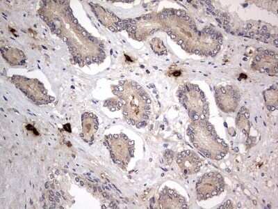 Immunohistochemistry: SMPD1 Antibody (OTI3H7) - Azide and BSA Free [NBP2-74240] - Analysis of Human prostate tissue. (Heat-induced epitope retrieval by 1 mM EDTA in 10mM Tris, pH8.5, 120C for 3min)