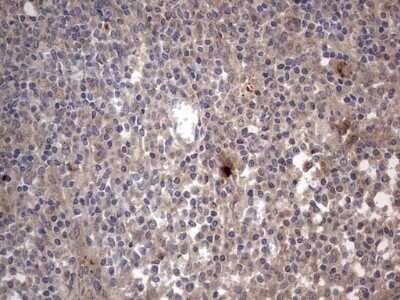 Immunohistochemistry: SMPD1 Antibody (OTI3H7) - Azide and BSA Free [NBP2-74240] - Analysis of Human tonsil tissue. (Heat-induced epitope retrieval by 1 mM EDTA in 10mM Tris, pH8.5, 120C for 3min)