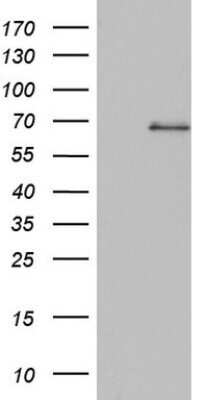 Western Blot: SMPD1 Antibody (OTI3H7) - Azide and BSA Free [NBP2-74240] - Analysis of HEK293T cells were transfected with the pCMV6-ENTRY control (Left lane) or pCMV6-ENTRY SMPD1.