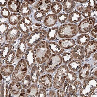 Immunohistochemistry-Paraffin: SMPDL3A Antibody [NBP1-88862] - Staining of human kidney shows strong cytoplasmic positivity with granular pattern in renal tubules.