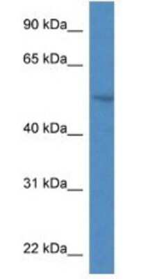 Western Blot SMPDL3A Antibody - BSA Free
