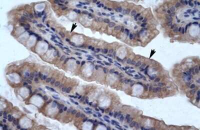 Immunohistochemistry SMPDL3B Antibody - BSA Free