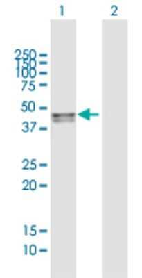 Western Blot: SMPDL3B Antibody [H00027293-B01P] - Analysis of SMPDL3B expression in transfected 293T cell line by SMPDL3B polyclonal antibody.  Lane 1: SMPDL3B transfected lysate(41.03 KDa). Lane 2: Non-transfected lysate.
