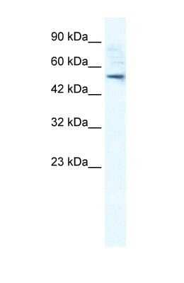 Western Blot SMPDL3B Antibody - BSA Free