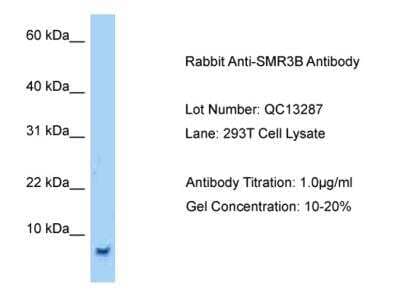 Western Blot: SMR3B Antibody [NBP2-84270] - Host: Rabbit. Target Name: SMR3B. Sample Tissue: Human 293T Whole Cell. Antibody Dilution: 1ug/ml