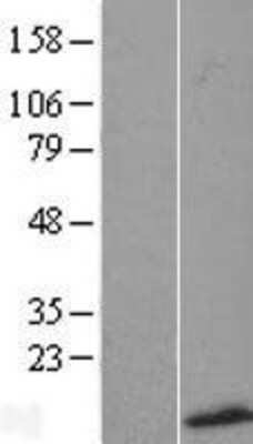 Western Blot: SMR3B Overexpression Lysate (Adult Normal) [NBL1-16255] Left-Empty vector transfected control cell lysate (HEK293 cell lysate); Right -Over-expression Lysate for SMR3B.