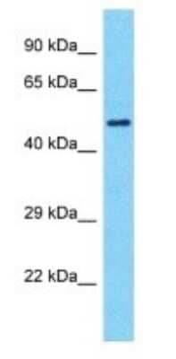 Western Blot: SMTNL1 Antibody [NBP3-09517] - Western blot analysis of SMTNL1 in Jurkat Whole Cell lysates. Antibody dilution at 1.0ug/ml