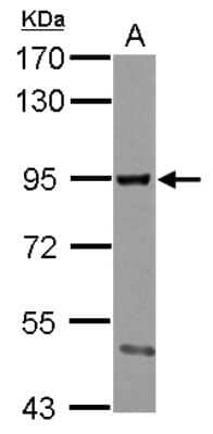 Western Blot: SMURF2 Antibody [NBP2-20427] - Sample (30 ug of whole cell lysate) A: MCF-7 7. 5% SDS PAGE gel, diluted at 1:500.