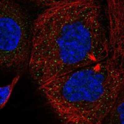 Immunocytochemistry/Immunofluorescence: SMURF1 Antibody [NBP3-17934] - Staining of human cell line A-431 shows localization to nucleoplasm & vesicles.