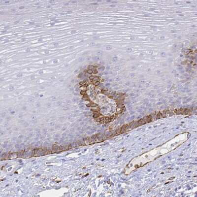 Immunohistochemistry-Paraffin: SMURF1 Antibody [NBP2-58156] - Staining of human esophagus shows membrane positivity in squamous epithelial cells.