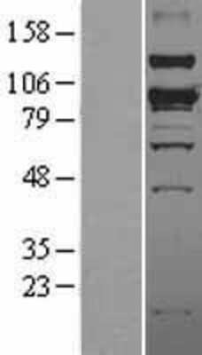 Western Blot: SMURF1 Overexpression Lysate (Adult Normal) [NBL1-16259] Left-Empty vector transfected control cell lysate (HEK293 cell lysate); Right -Over-expression Lysate for SMURF1.