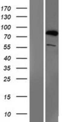 Western Blot: SMURF1 Overexpression Lysate (Adult Normal) [NBP2-06648] Left-Empty vector transfected control cell lysate (HEK293 cell lysate); Right -Over-expression Lysate for SMURF1.