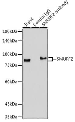 Immunoprecipitation: SMURF2 Antibody (8O7F0) [NBP3-16105] - Immunoprecipitation analysis of 300ug extracts of Mouse lung cells using 3ug SMURF2 antibody (NBP3-16105). Western blot was performed from the immunoprecipitate using SMURF2 antibody (NBP3-16105) at a dilition of 1:1000.