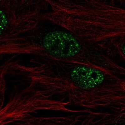 Immunocytochemistry/Immunofluorescence: SMURF2 Antibody [NBP2-57554] - Staining of human cell line BJ shows localization to nuclear speckles. Antibody staining is shown in green.