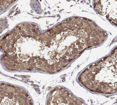 Immunohistochemistry-Paraffin: SMURF2 Antibody [NBP2-57554] - Staining of human testis shows strong cytoplasmic positivity in cells in seminiferous ducts.