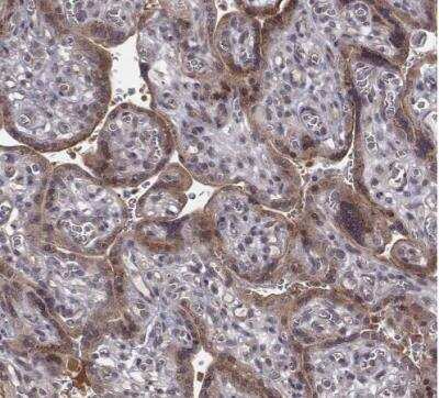 Immunohistochemistry-Paraffin: SMURF2 Antibody [NBP2-57554] - Staining of human placenta shows moderate cytoplasmic positivity in trophoblastic cells.