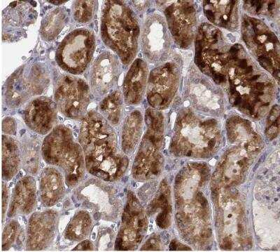 Immunohistochemistry-Paraffin: SMURF2 Antibody [NBP2-57554] - Staining of human kidney shows strong cytoplasmic positivity in cells in tubules.