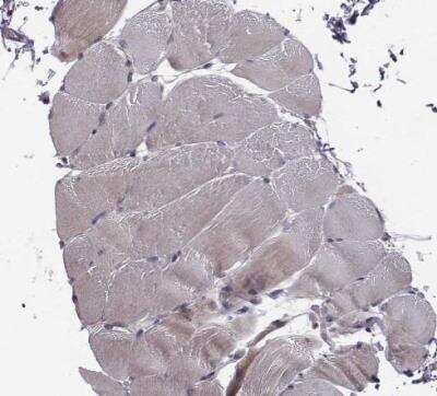 Immunohistochemistry-Paraffin: SMURF2 Antibody [NBP2-57554] - Staining of human skeletal muscle shows no positivity in myocytes as expected.