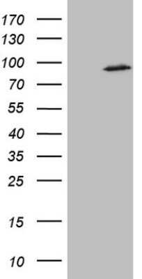 Western Blot: SMURF2 Antibody (OTI3E4) - Azide and BSA Free [NBP2-74241] - Analysis of HEK293T cells were transfected with the pCMV6-ENTRY control (Left lane) or pCMV6-ENTRY SMURF2.