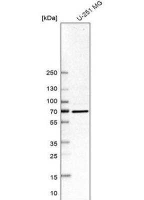 Western Blot SMURF2 Antibody