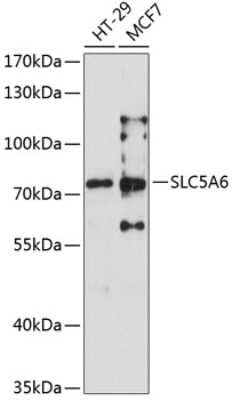 Western Blot: SMVT/SLC5A6 Antibody [NBP2-94016] - Analysis of extracts of various cell lines, using SMVT/SLC5A6 . Exposure time: 90s.