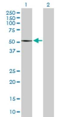 Western Blot: SMYD2 Antibody [H00056950-D01P] - Analysis of SMYD2 expression in transfected 293T cell line by SMYD2 polyclonal antibody.Lane 1: SMYD2 transfected lysate(49.70 KDa).Lane 2: Non-transfected lysate.