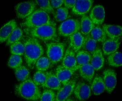 Immunocytochemistry/Immunofluorescence: SMYD3 Antibody (JM73-63) [NBP2-75668] - Staining SMYD3 in HepG2 cells (green). The nuclear counter stain is DAPI (blue). Cells were fixed in paraformaldehyde, permeabilised with 0.25% Triton X100/PBS.