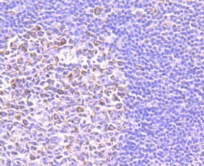 Immunohistochemistry-Paraffin: SMYD3 Antibody (JM73-63) [NBP2-75668] - Analysis of paraffin-embedded human tonsil tissue using anti-SMYD3 antibody. Counter stained with hematoxylin.