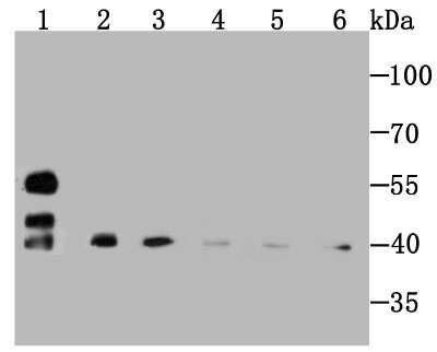 Western Blot: SMYD3 Antibody (JM73-63) [NBP2-75668] - Analysis of SMYD3 on different cell/tissue lysate using anti-Profilin 1 antibody at 1/1,000 dilution.Positive control:Lane1: Rat kidney     Lane2: PC-12Lane3: Hela           Lane4: Mouse spleenLane5: NIH-3T3        Lane6: Rat spleen